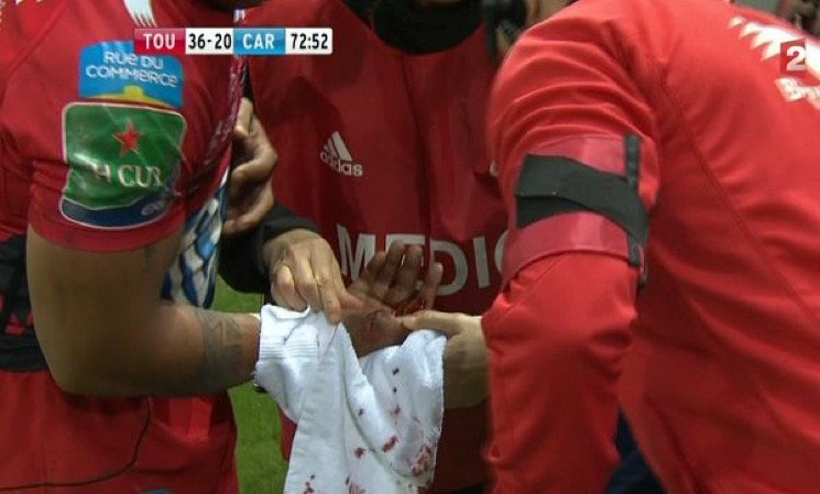 smith blessure main